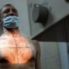 Больного туберкулезом пришлось насильно госпитализировать