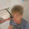 Секатор вонзился в лицо 14-летнему подростку во время игры с братом в...