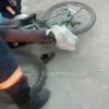 Тормозная ручка от велосипеда пробила бедро мальчику в Новосибирске