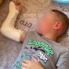 Ребёнок сломал руку в детском саду Екатеринбурга, пока воспитательница сидела...