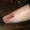 В Прокопьевске бродячая собака напала и покусала ребёнка на улице Пионерской...