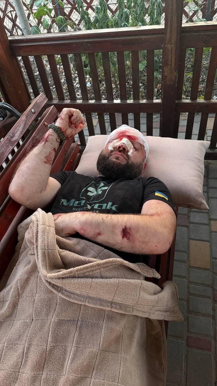 Одесситы проломили череп всушнику арматурой за требование выключить русскую музыку