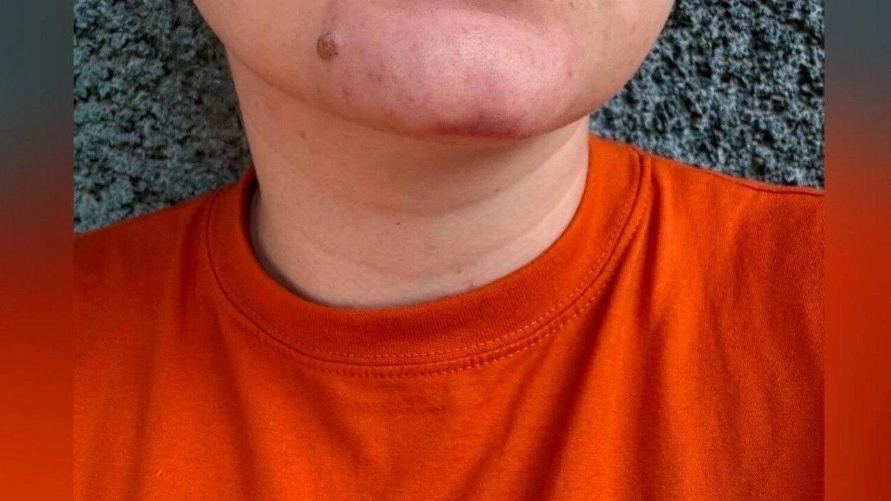 Хозяйка «кошачьего концлагеря» в Новосибирске напала на волонтёра В...