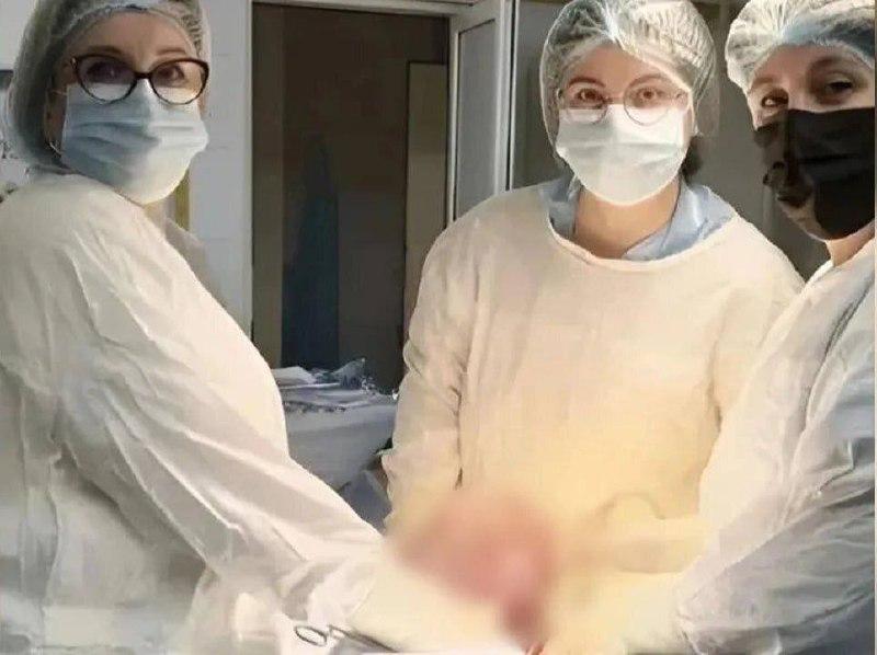 Красноярские врачи удалили пациентке гигантскую миому размером более 30...