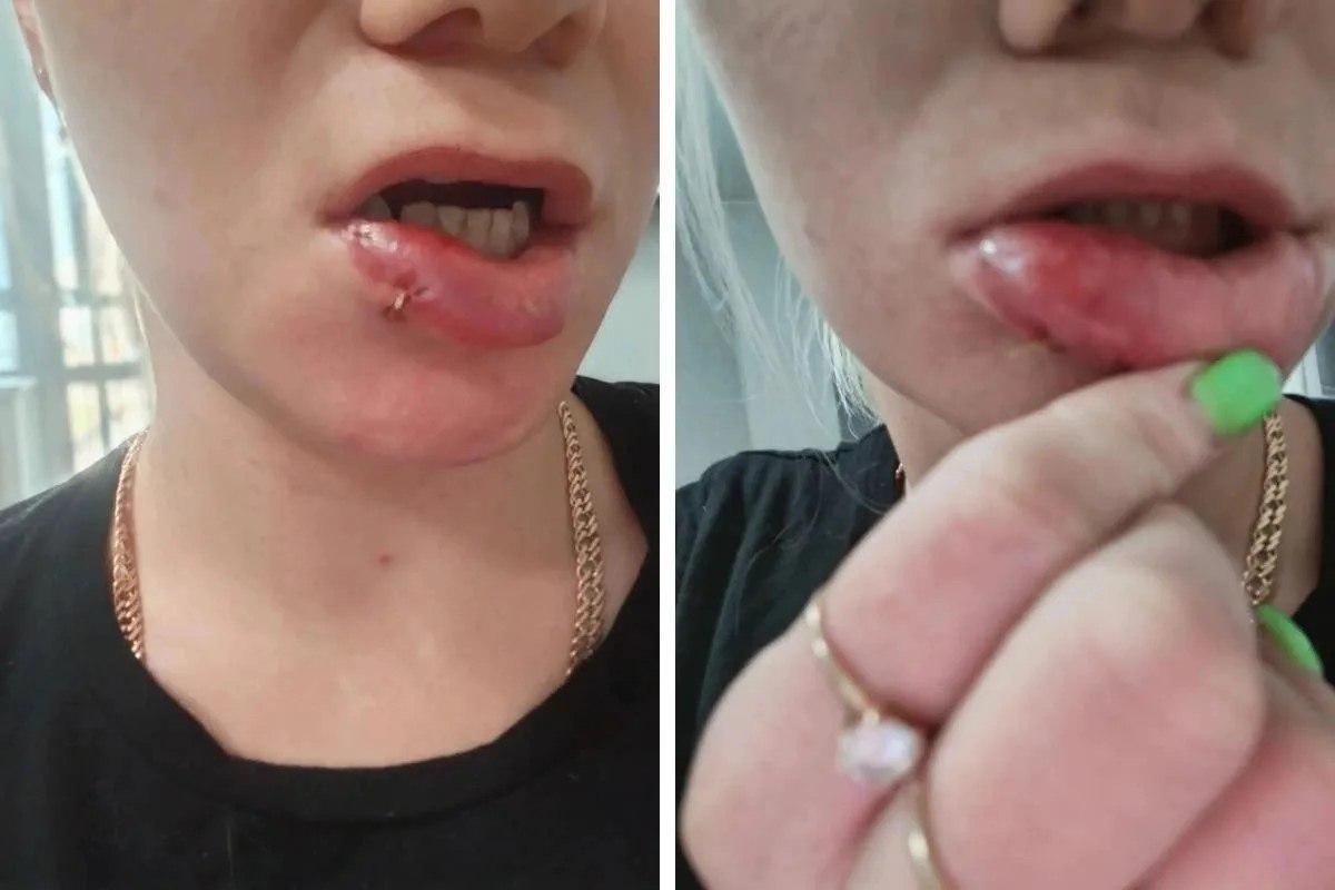 Сосед избил женщину из-за пения Позавчера около полуночи 37-летняя Антонида...