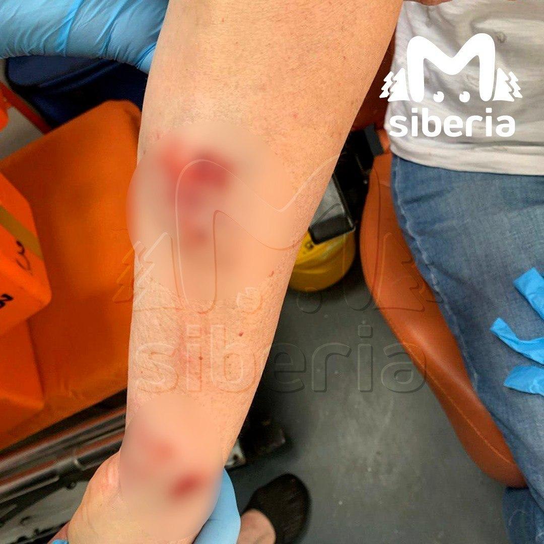 Овчарка напала на женщину у многоэтажки в Новосибирске. По словам...