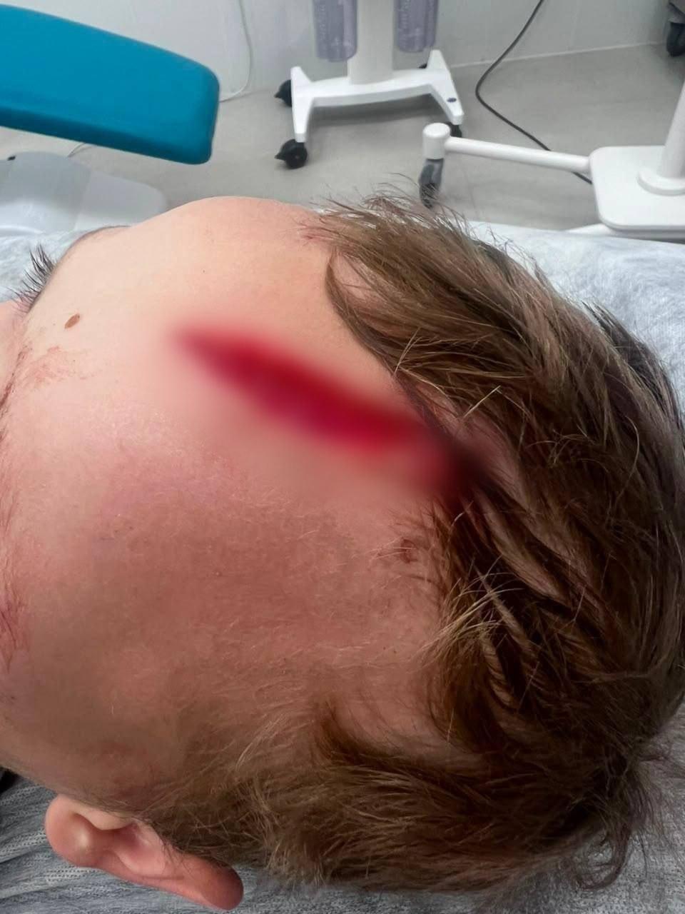 На внука Дарьи Донцовой напала собака у его дома в Подмосковье — огромный пёс...