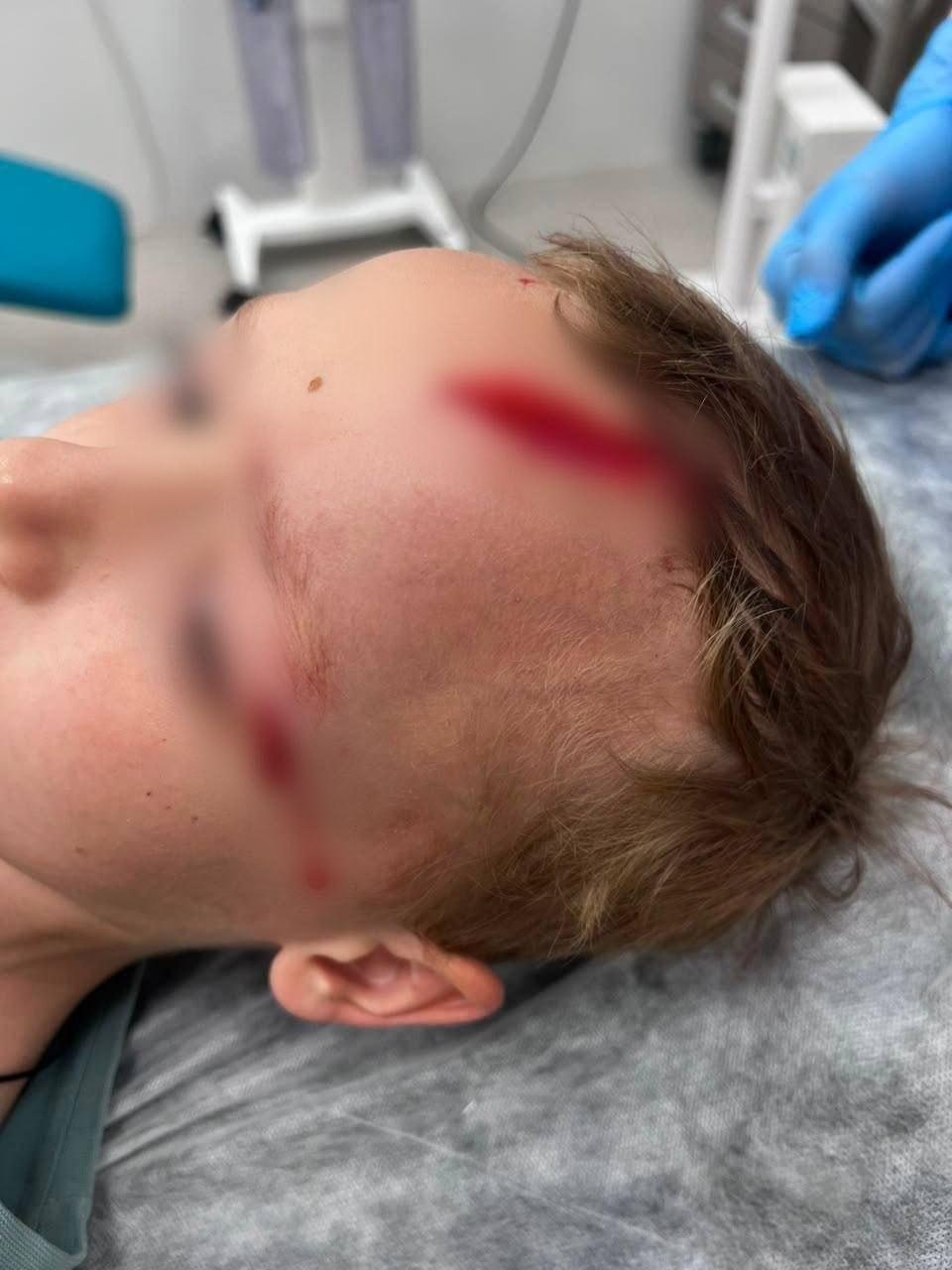 На внука Дарьи Донцовой напала собака у его дома в Подмосковье — огромный пёс...