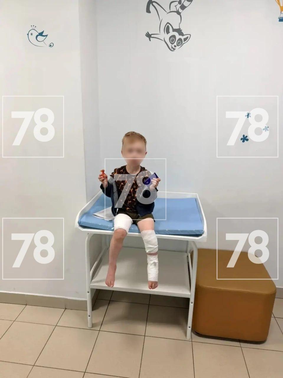 Бультерьер снова напал на ребёнка. В деревне Коккорево соседский бультерьер...