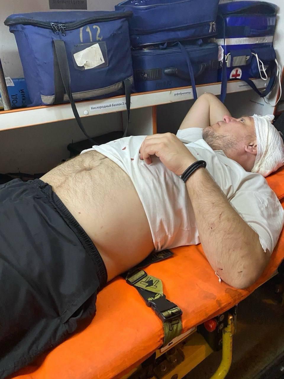 Трое бородачей избили мужчину за замечание после того, как едва не сбили супружескую пару на зебре в Тольятти