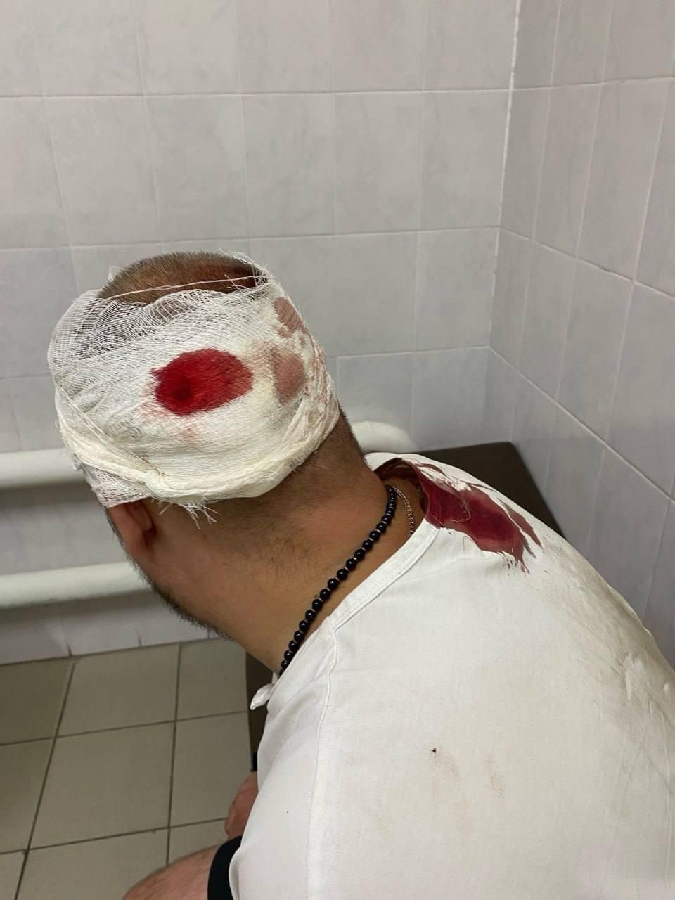Трое бородачей избили мужчину за замечание после того, как едва не сбили супружескую пару на зебре в Тольятти