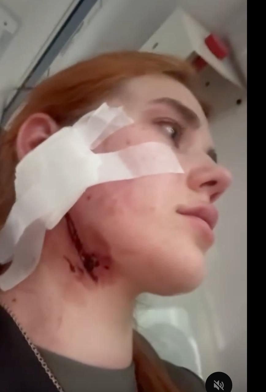 Во Вроцлаве трое поляков жестоко избили украинца и его девушку, потому что...