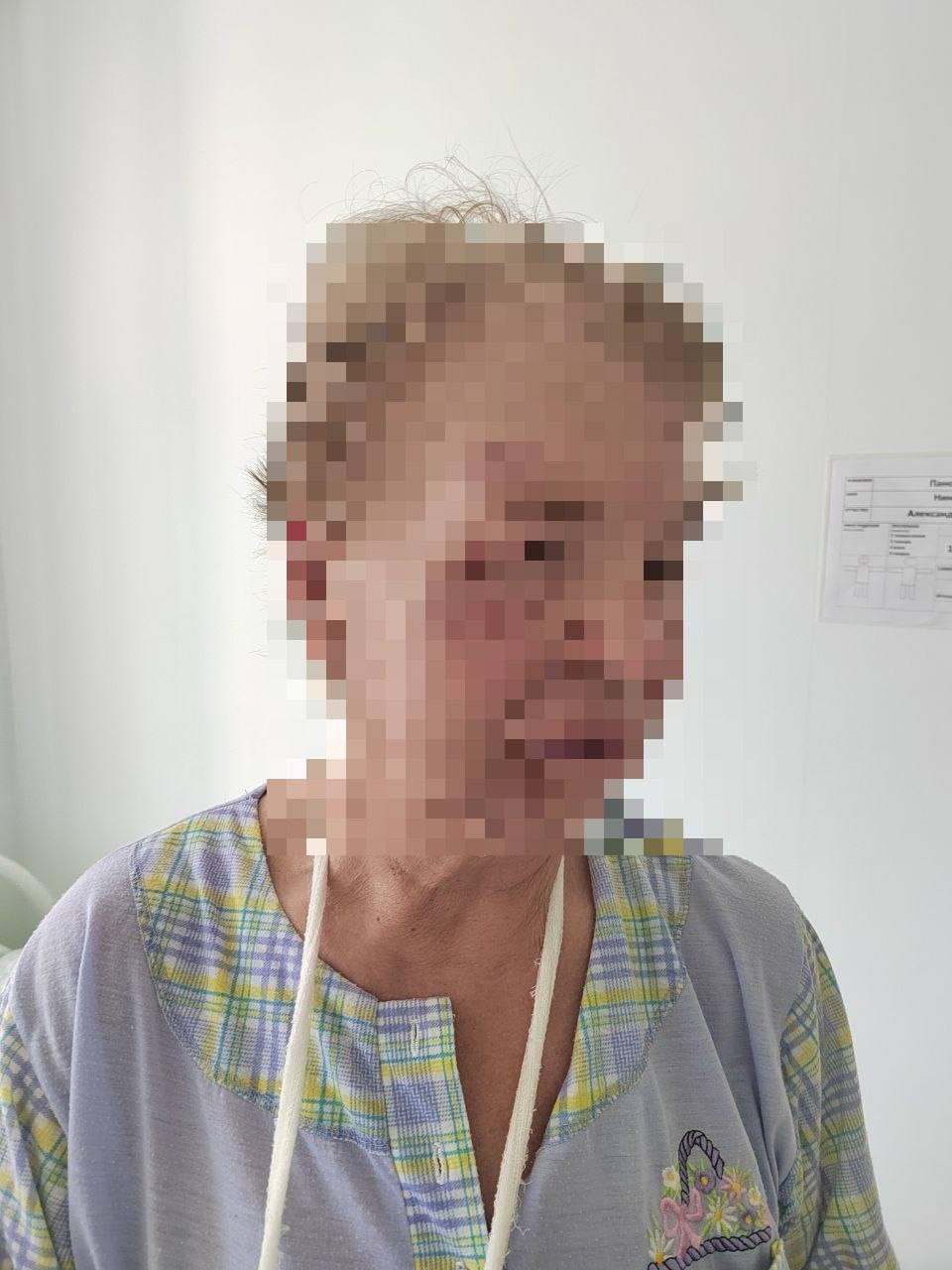 В Екатеринбурге подростки на электросамокате сбили 77-летнюю пенсионерку