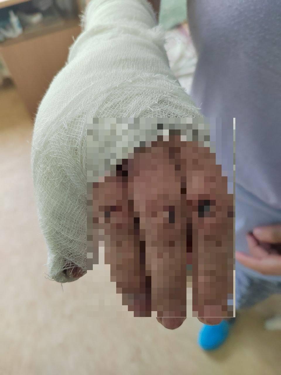В Екатеринбурге подростки на электросамокате сбили 77-летнюю пенсионерку