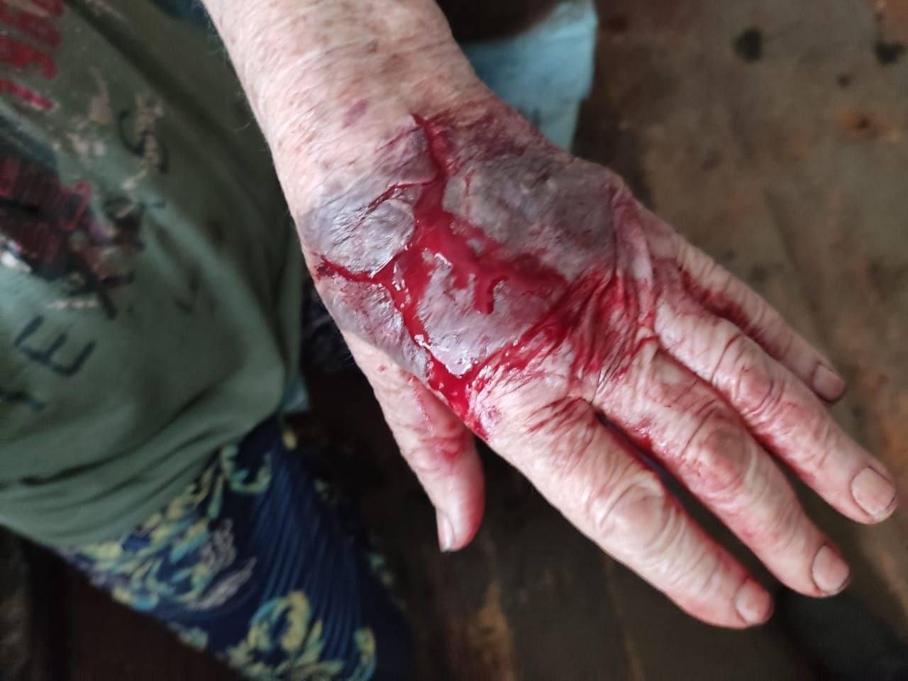 85-летнюю вдову участника ВОВ жестоко избили до потери сознания из-за дома в Приморье