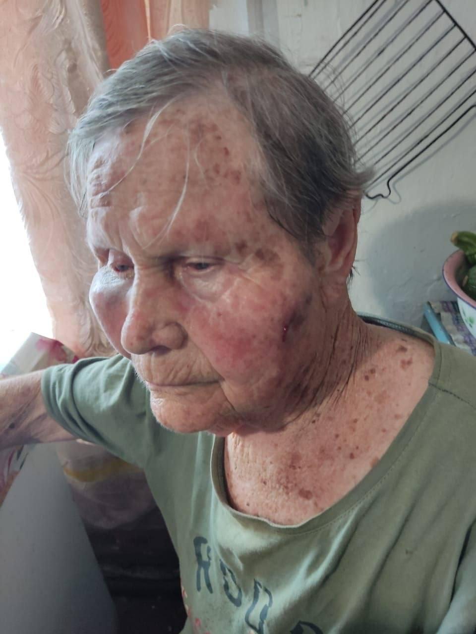 85-летнюю вдову участника ВОВ жестоко избили до потери сознания из-за дома в Приморье