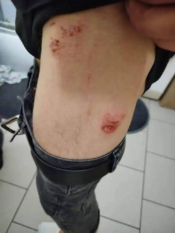 Из-за громкой музыки поляки напали на украинцев на территории хостела в...