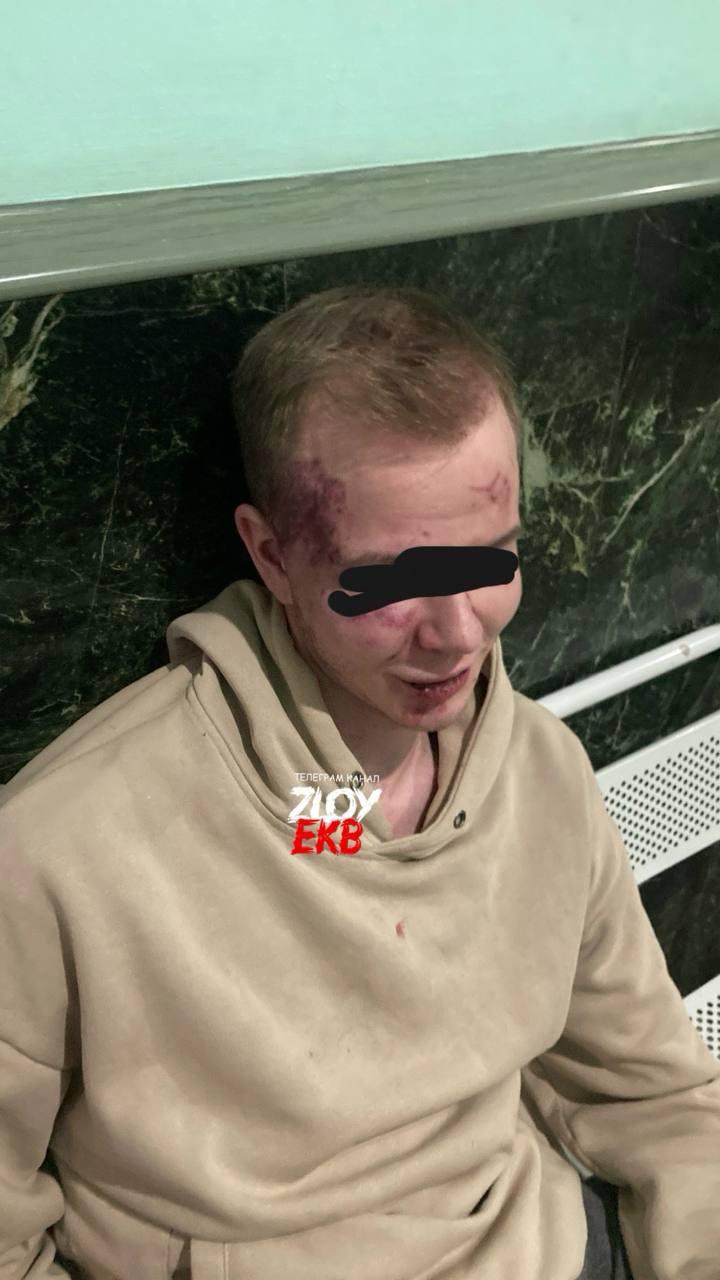 Жестокое нападение в Екатеринбурге: молодые люди были избиты толпой