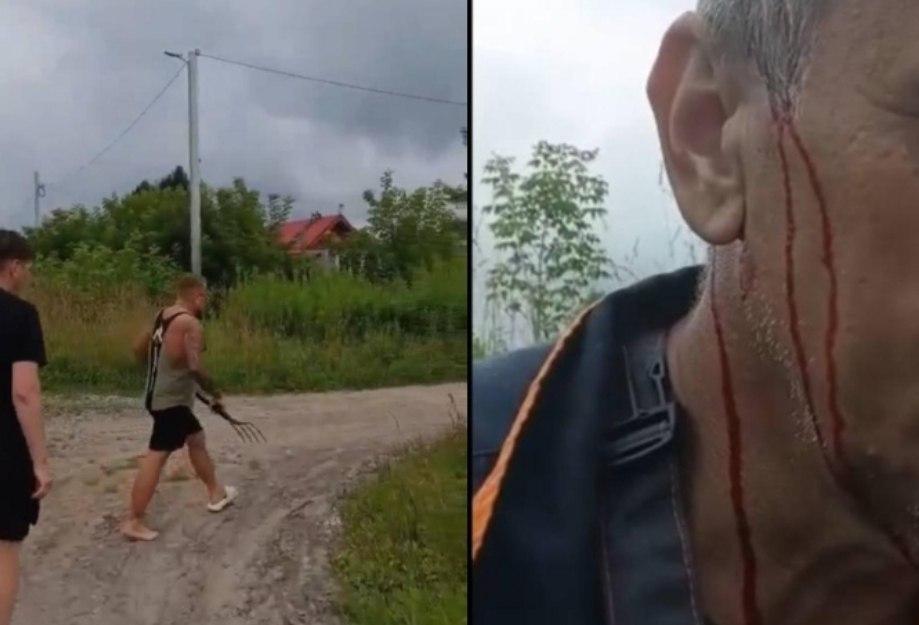 Полиция расследует драку в СНТ с участием вил В Новосибирской области полиция...