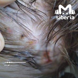 Личинки мух выросли в голове годовалого ребёнка в Новосибирске. По словам...