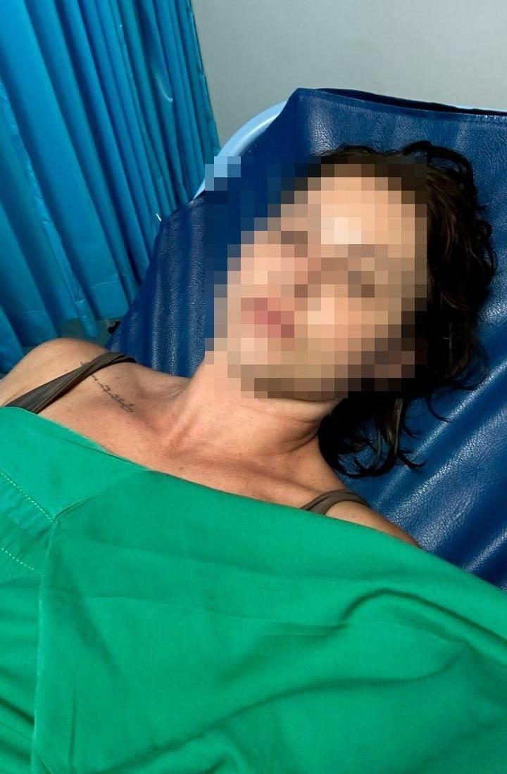 Россиянку парализовало после встречи с «португальским корабликом» на Бали, — СМИ.