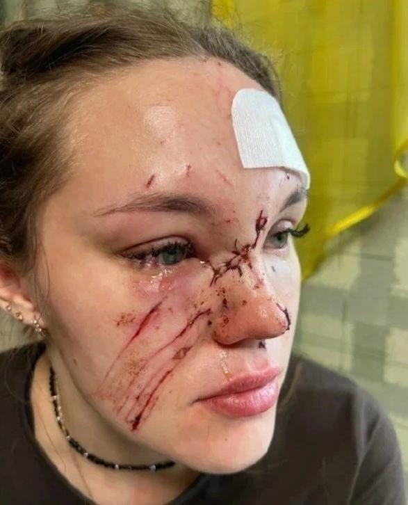 В кировском ночном клубе медсестра 