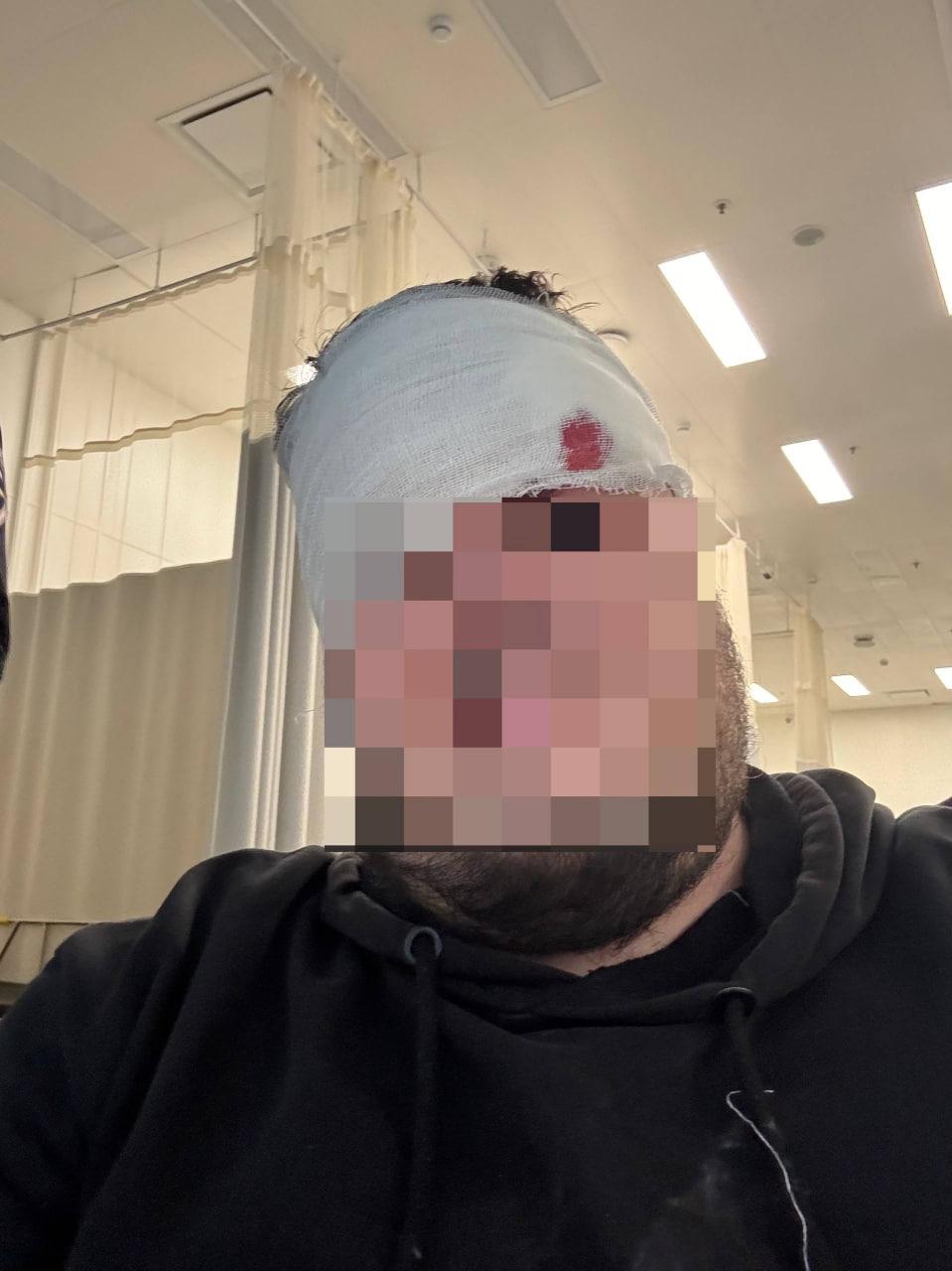 Обрушившаяся лепнина едва не убила пассажира в московском метро На станции...