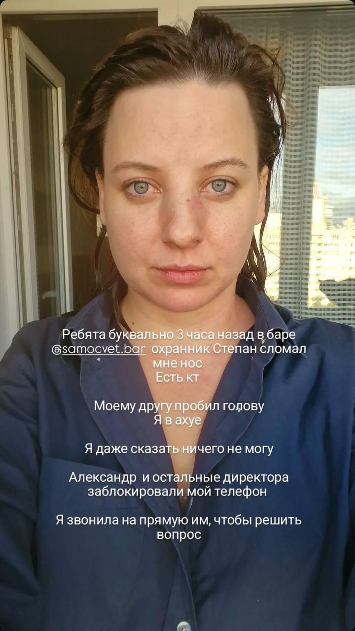 Охранники бара избили троих посетителей в Екатеринбурге: девушке сломали нос