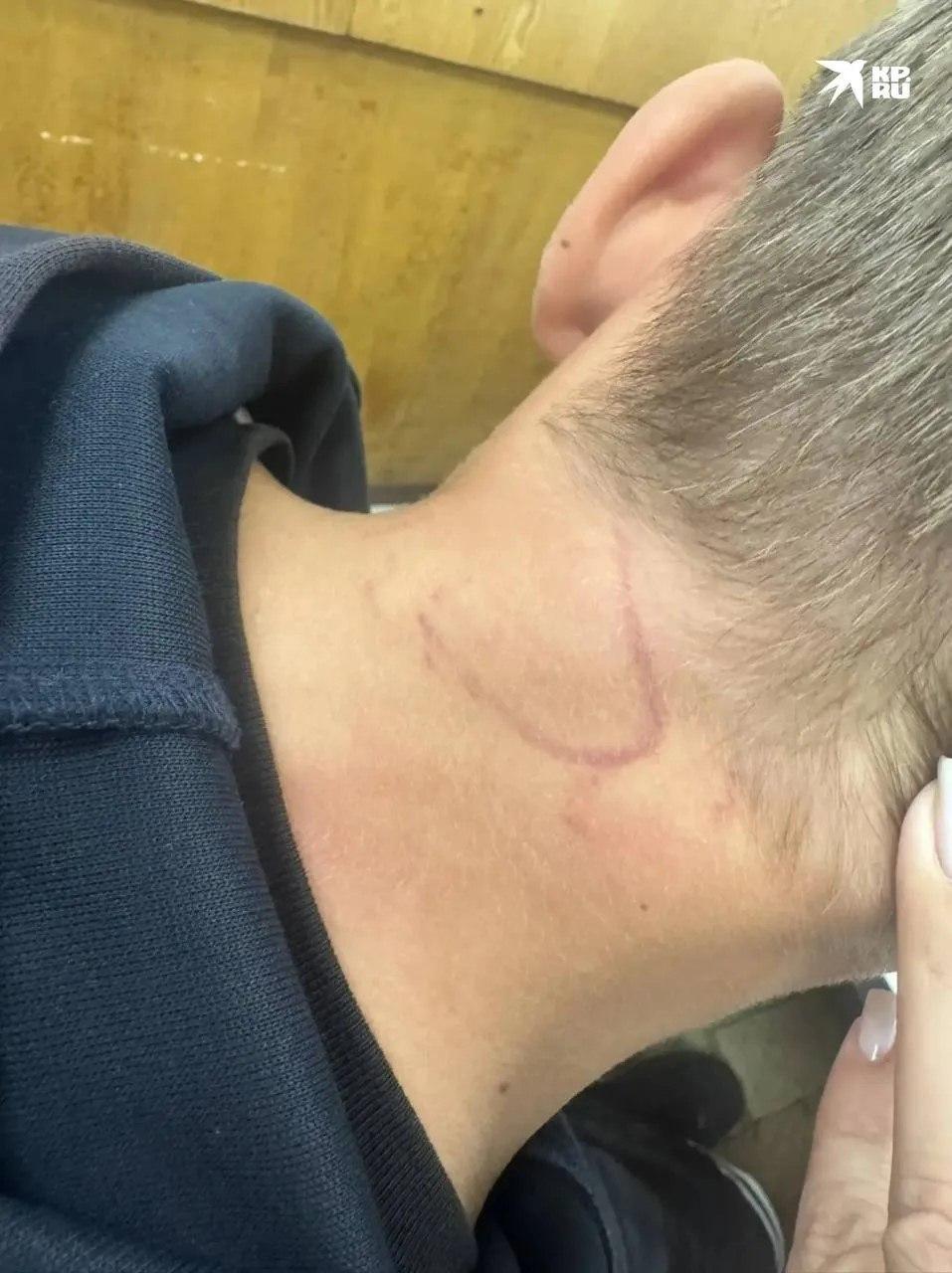 В Новосибирске подростки избили 12-летнего мальчика, отказавшегося отдать...