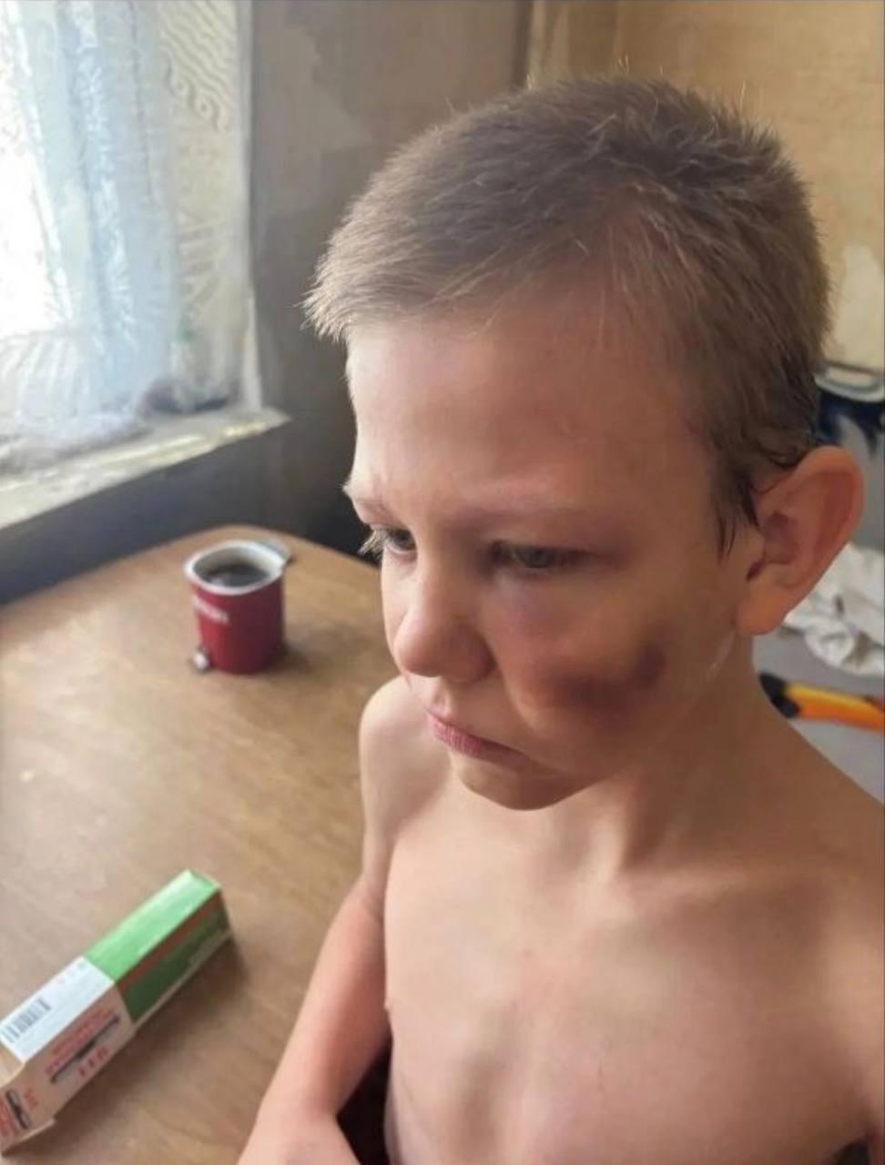 В Самаре отец избивал своего 9-летнего сына