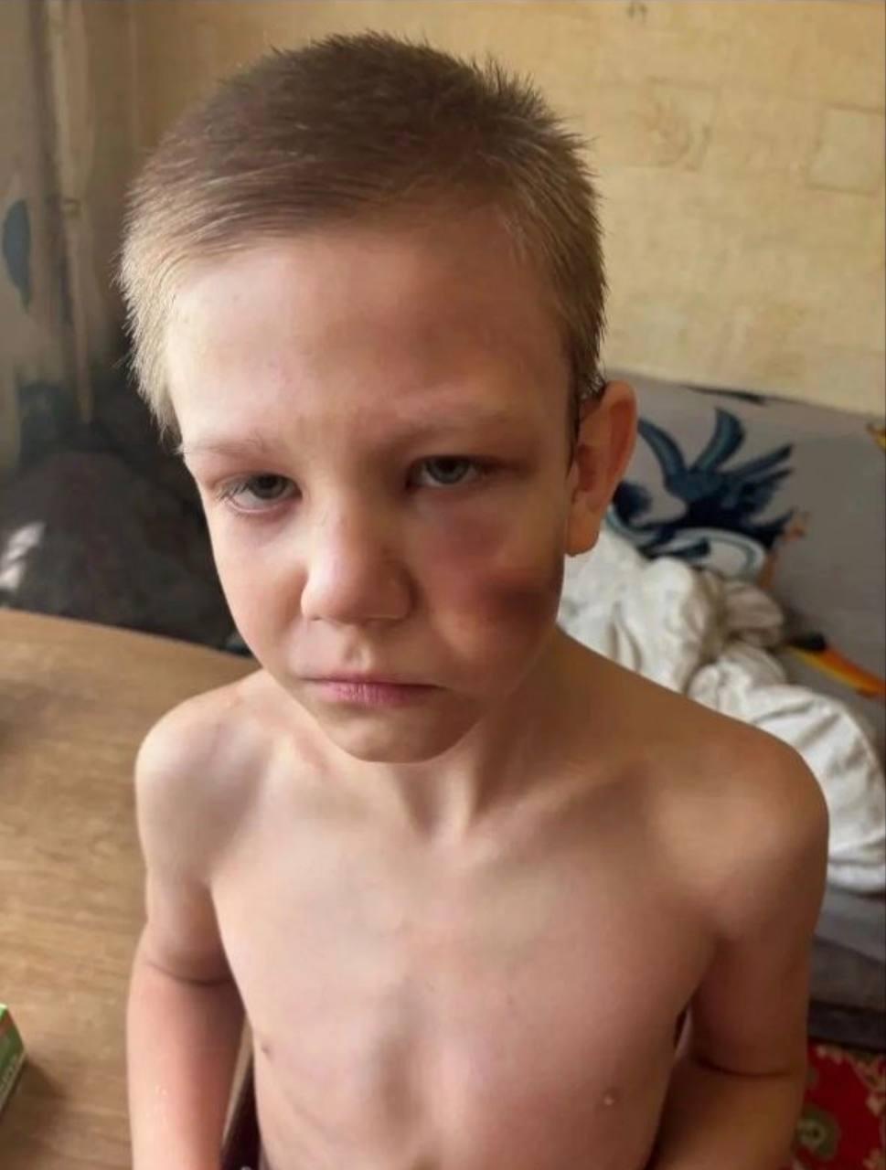 В Самаре отец избивал своего 9-летнего сына