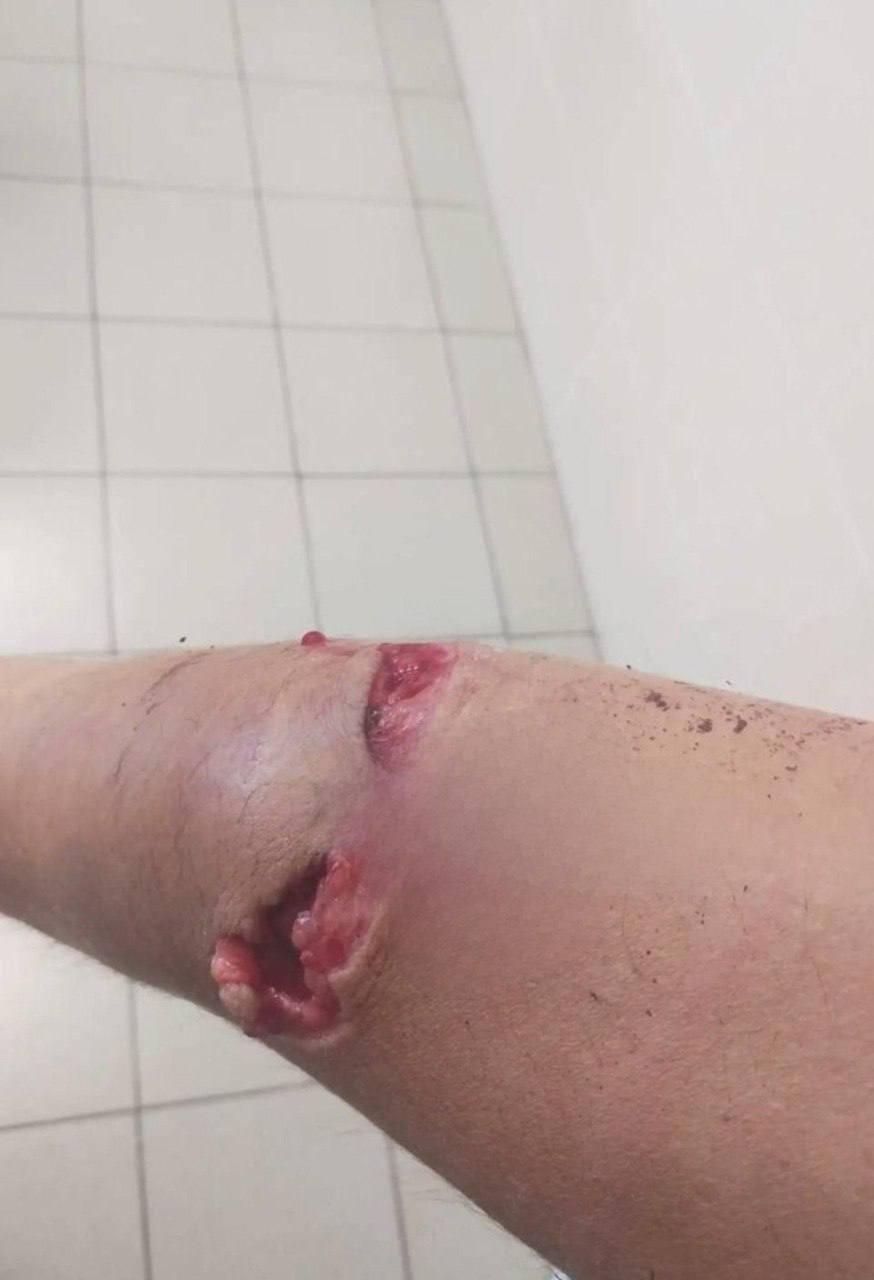 В Новокузнецке мужчина пошел в ТЦ за покупками и внезапно разбил собой...