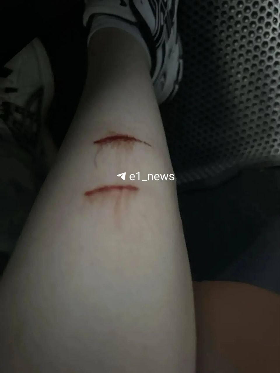 В Екатеринбурге стая собак напала на 16-летнюю девушку по дороге в колледж