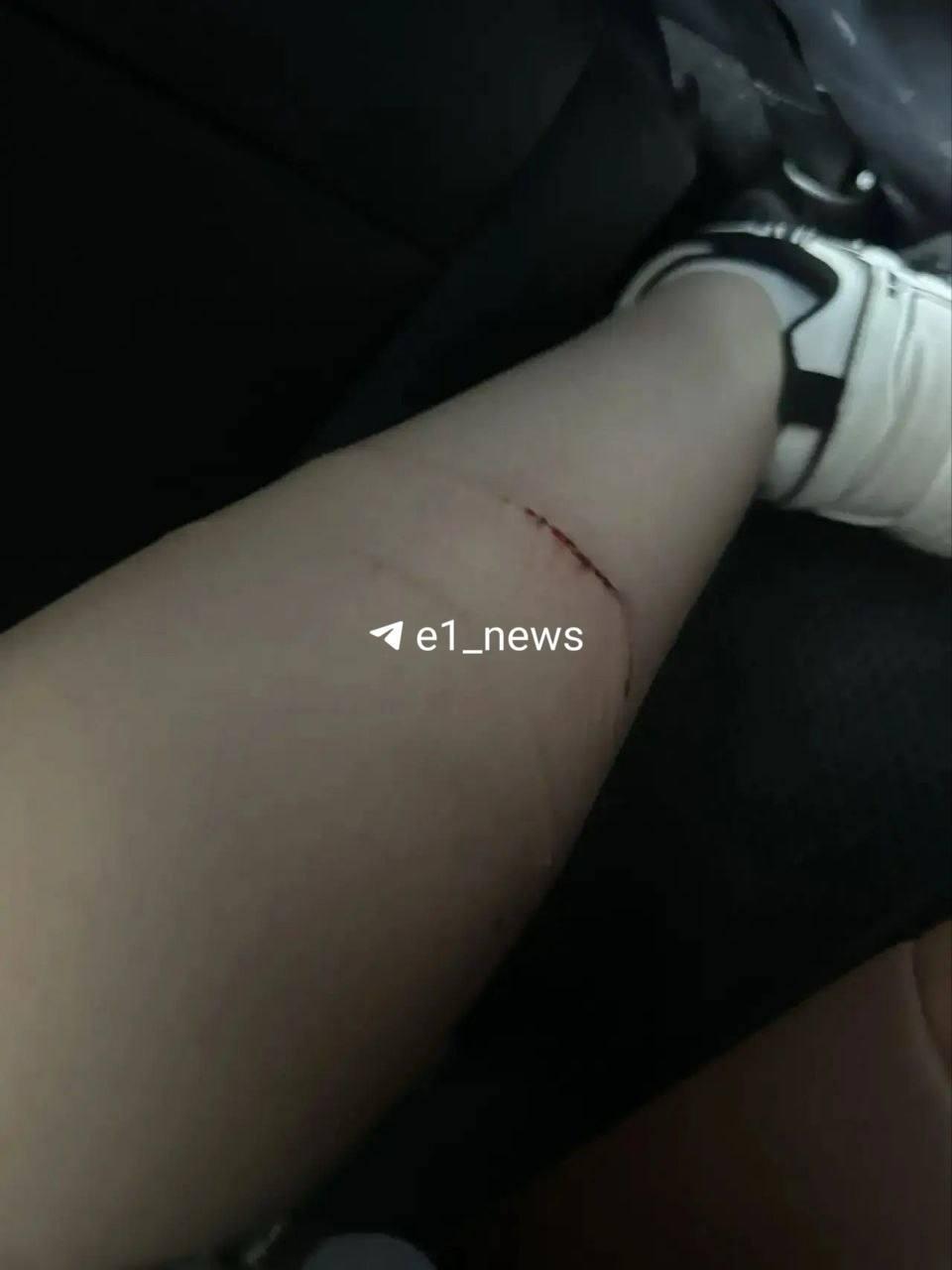 В Екатеринбурге стая собак напала на 16-летнюю девушку по дороге в колледж