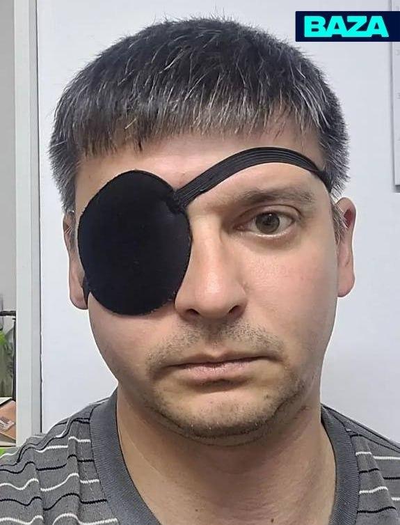 Уфимец лишился глаза, пока лечил отслойку сетчатки — врачи не справились за...