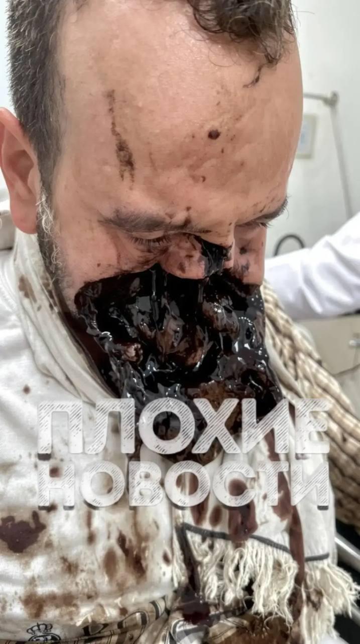 Мотоциклисту оторвало часть лица в жестоком ДТП в Колумбии.