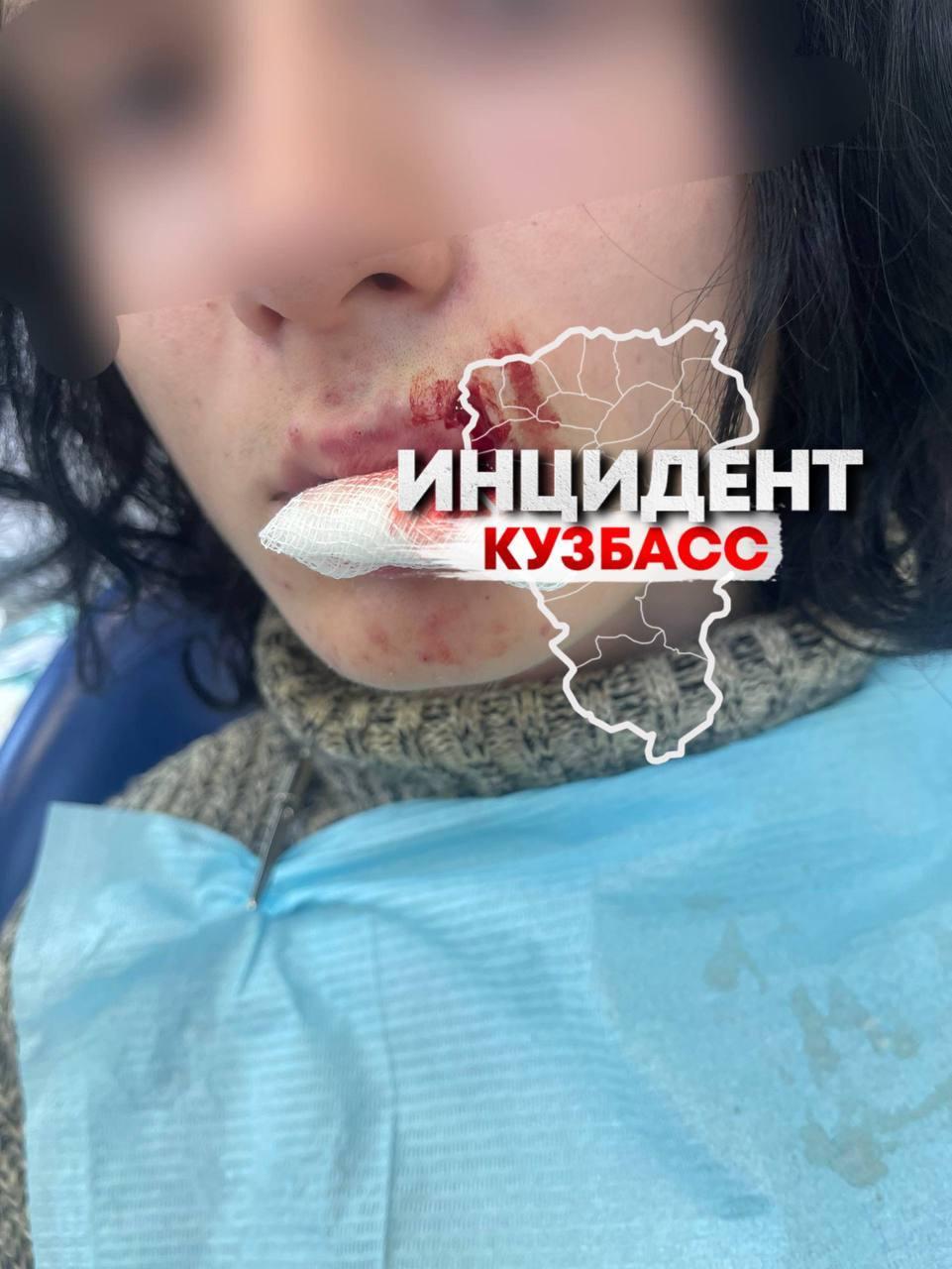 Драка в школе №85: девятиклассник получил серьёзные травмы. Автор утверждает, что конфликту предшествовали длительные издевательства
