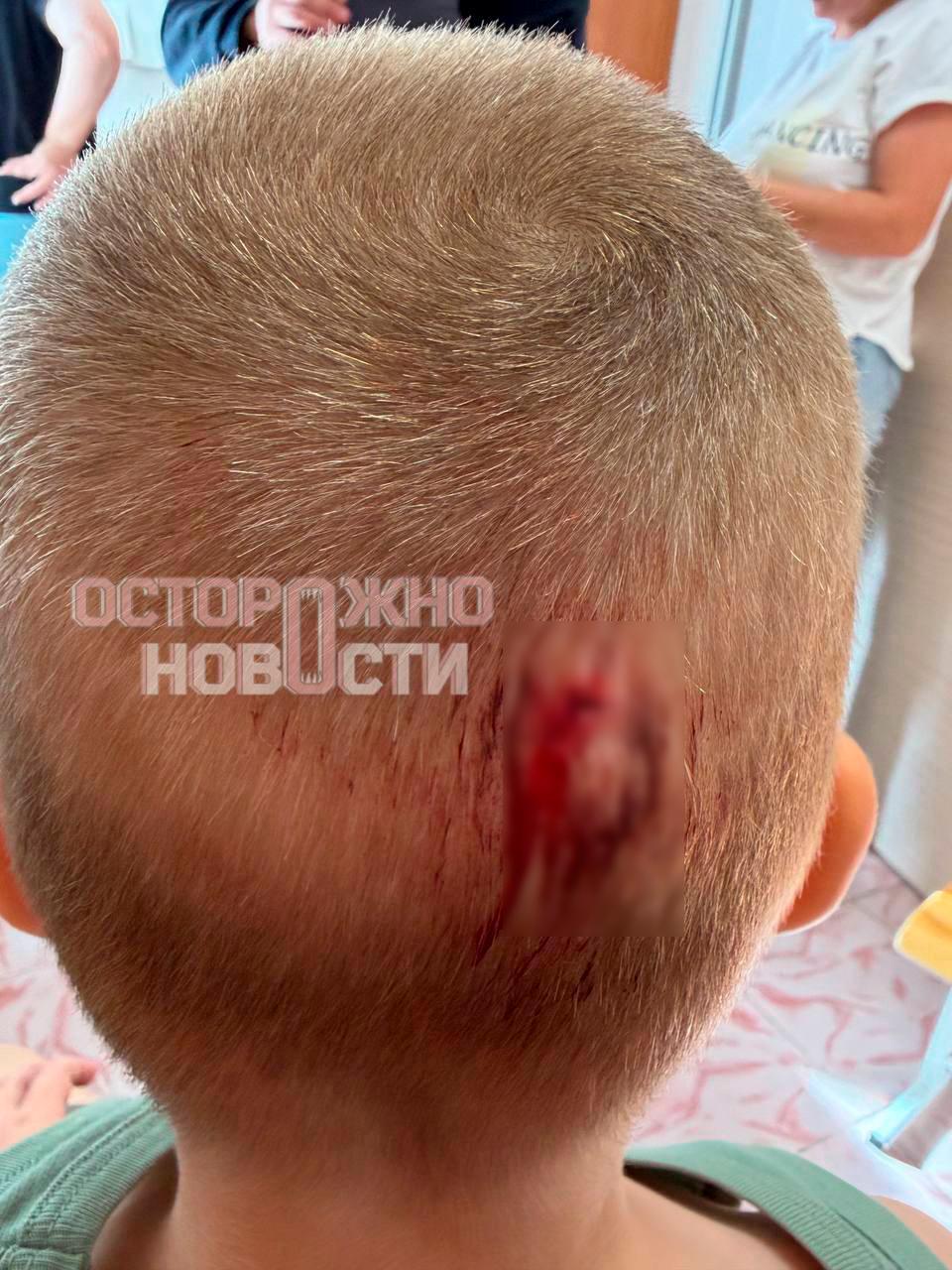 В детском саду Томска дети получили травмы из-за падения шкафа на них. Ранее родители систематически жаловались на условия в учреждении.