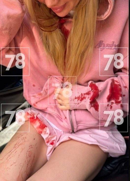 Туристке из Петербурга пробило голову камнем во время фотосессии у водопада в Азербайджане