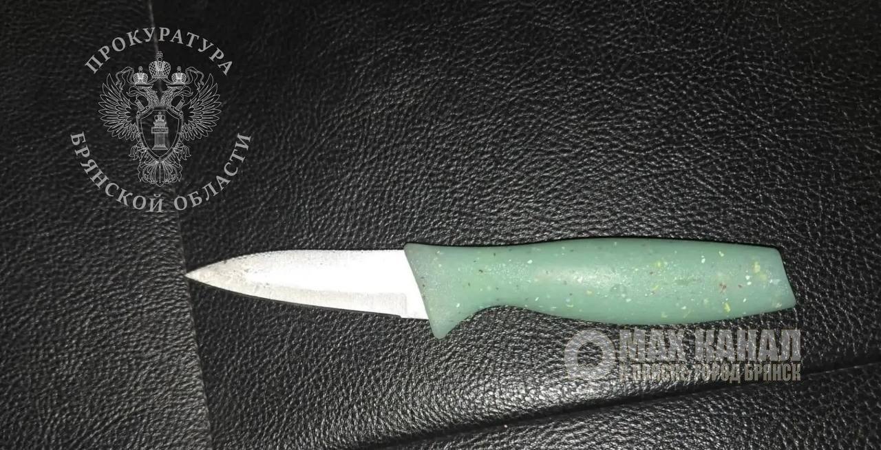 Прокуратура Советского района Брянска контролирует расследование уголовного дела о тяжком вреде здоровью местного жителя