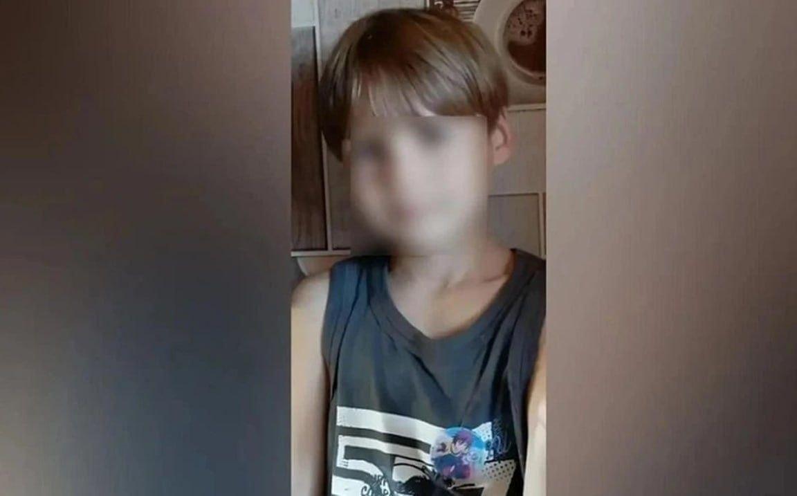 В Краснодарском крае сторожевые собаки набросились на 12-летнего мальчика: ребенок лишился уха и кожи на плече и голове