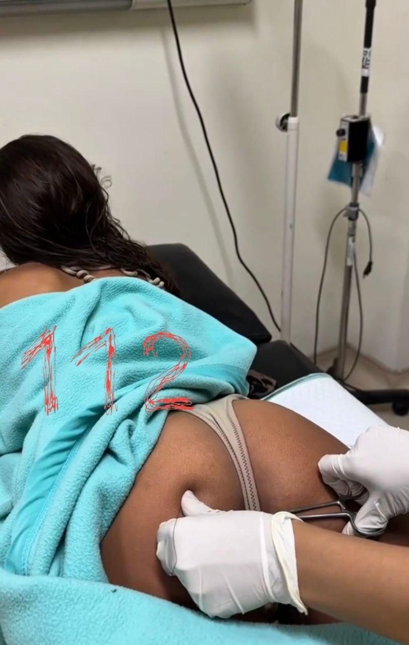 «Мне порвали жопу!» В Индонезии москвичке порвали туз — ей в ягодицу...