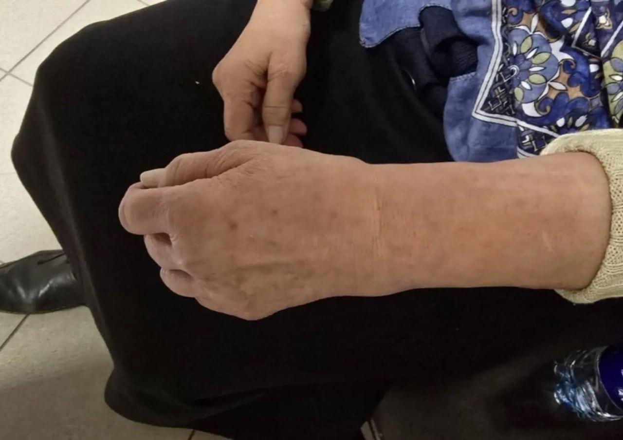 В Санкт-Петербурге самокатчик сбил 80-летнюю бабушку и уехал, оставив ее