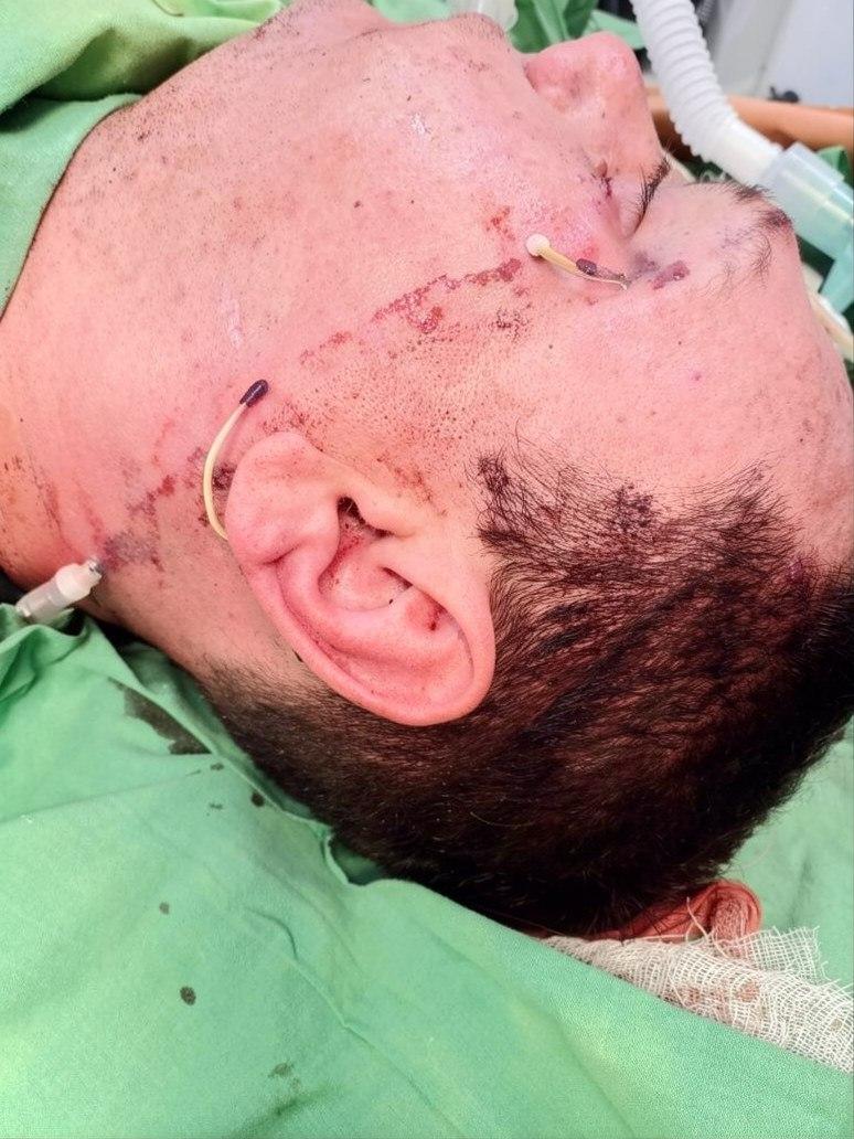 В Подмосковье мужчина с ножом напал на троих человек во время празднования юбилея из-за шума