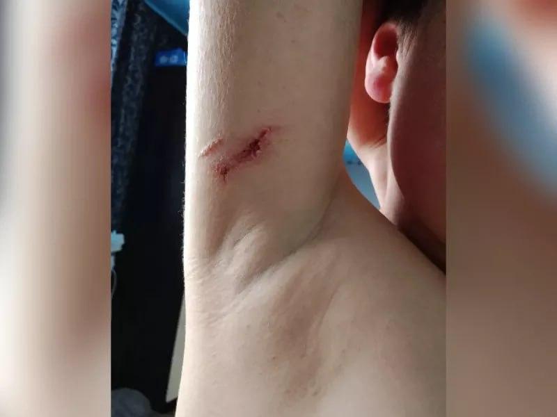В Тюхтете с владельцев бойцовских собак требуют компенсацию за покусанных...