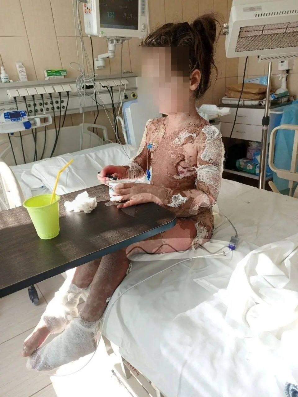 В Воронежской области у 7-летней девочки слезла кожа после приёма лекарства — врач назначила ей препарат без обследований