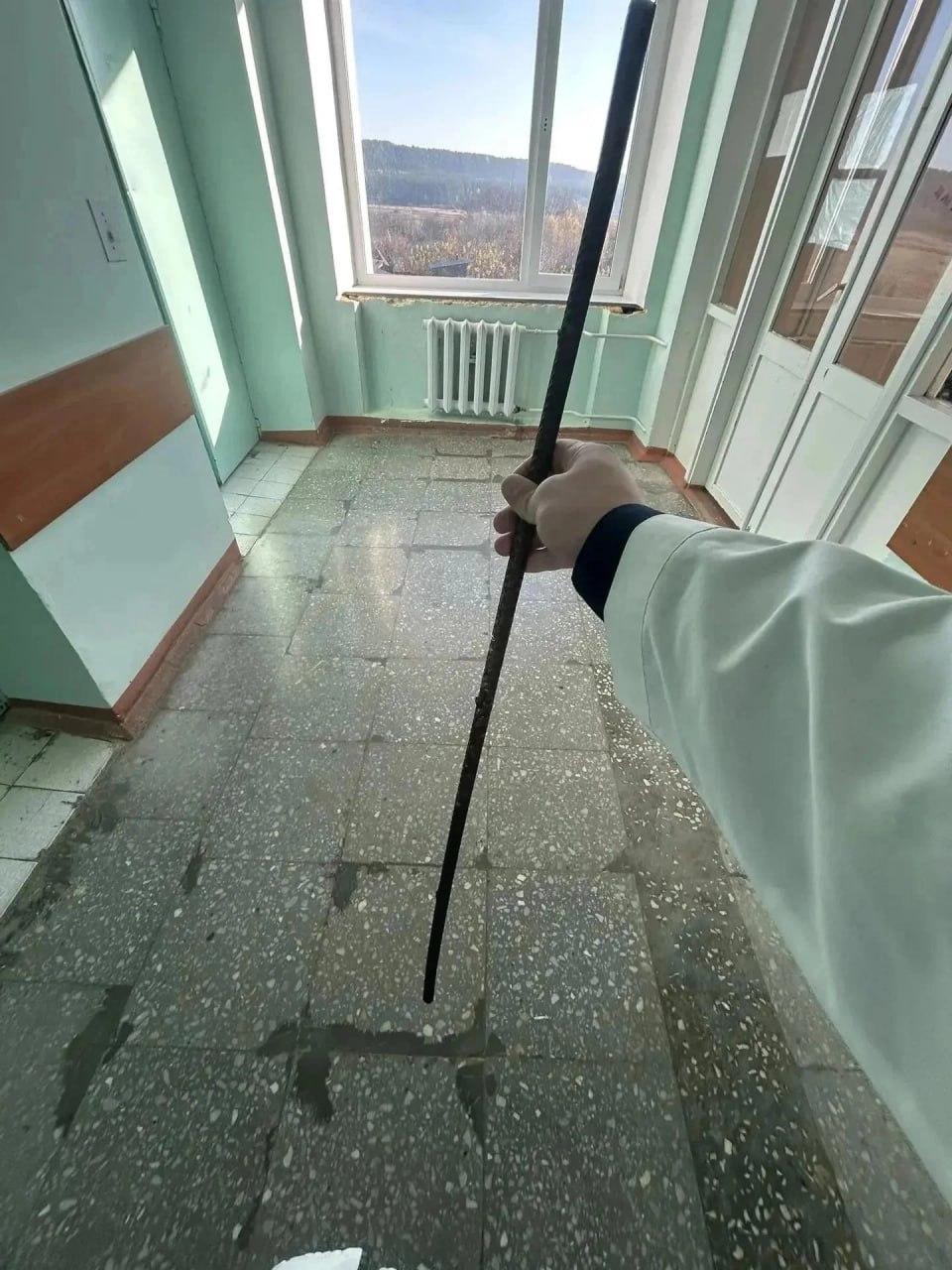 В Кировской области спасли ребёнка, которого почти насквозь прошил...