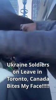 В Канаде пьяный ВСУшник укусил уличного музыканта за щёку после того, как тот...