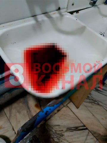 В Красноярске мужчина ранил ножом своего стаффордширского...