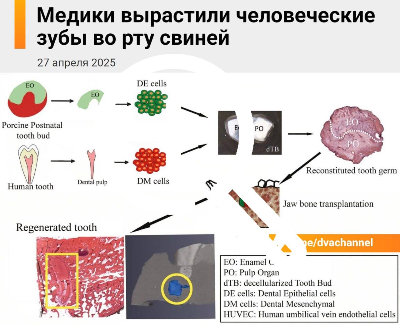 Пломбы умерли сегодня: учёные научились выращивать человеческие зубы в… челюстях свиней.